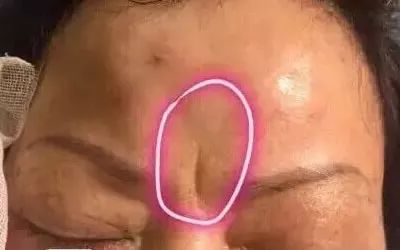 印堂有悬针纹命运 悬针纹面相图解 图片